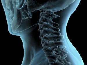 Methoden zur Diagnose der Osteochondrose des Halses