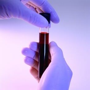 Blut im Reagenzglas
