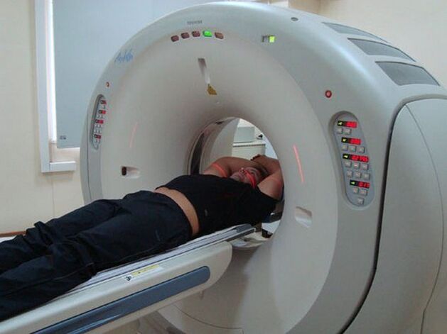 Diagnose von Osteochondrose