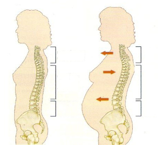Osteochondrose während der Schwangerschaft